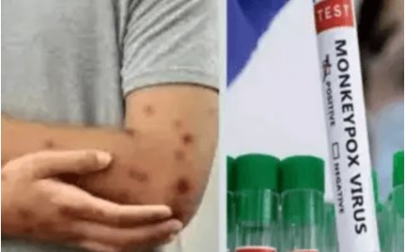 UAE Reports First Case of Dangerous New Mpox Clade, Alarming Outbreak