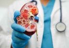 Protect Your Kidneys: Nephrologist Reveals 6 Essential Daily Habits for Better Health